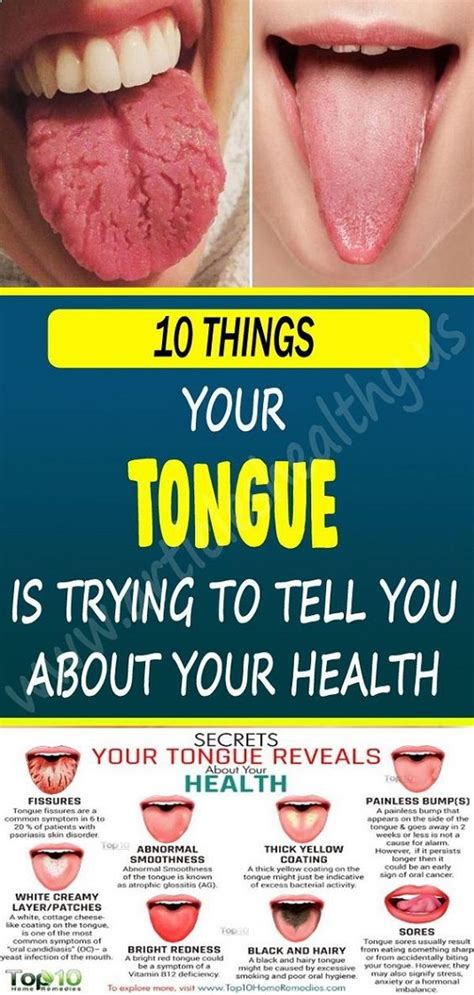 What Your Tongue Says About Your Health